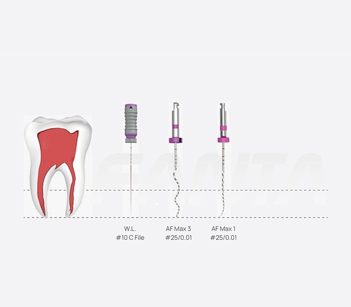 Fanta Dental Sp Af Max Rotary File Dandal File Model V Af Max