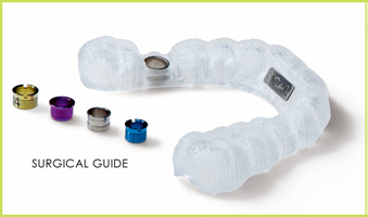 digital implantology