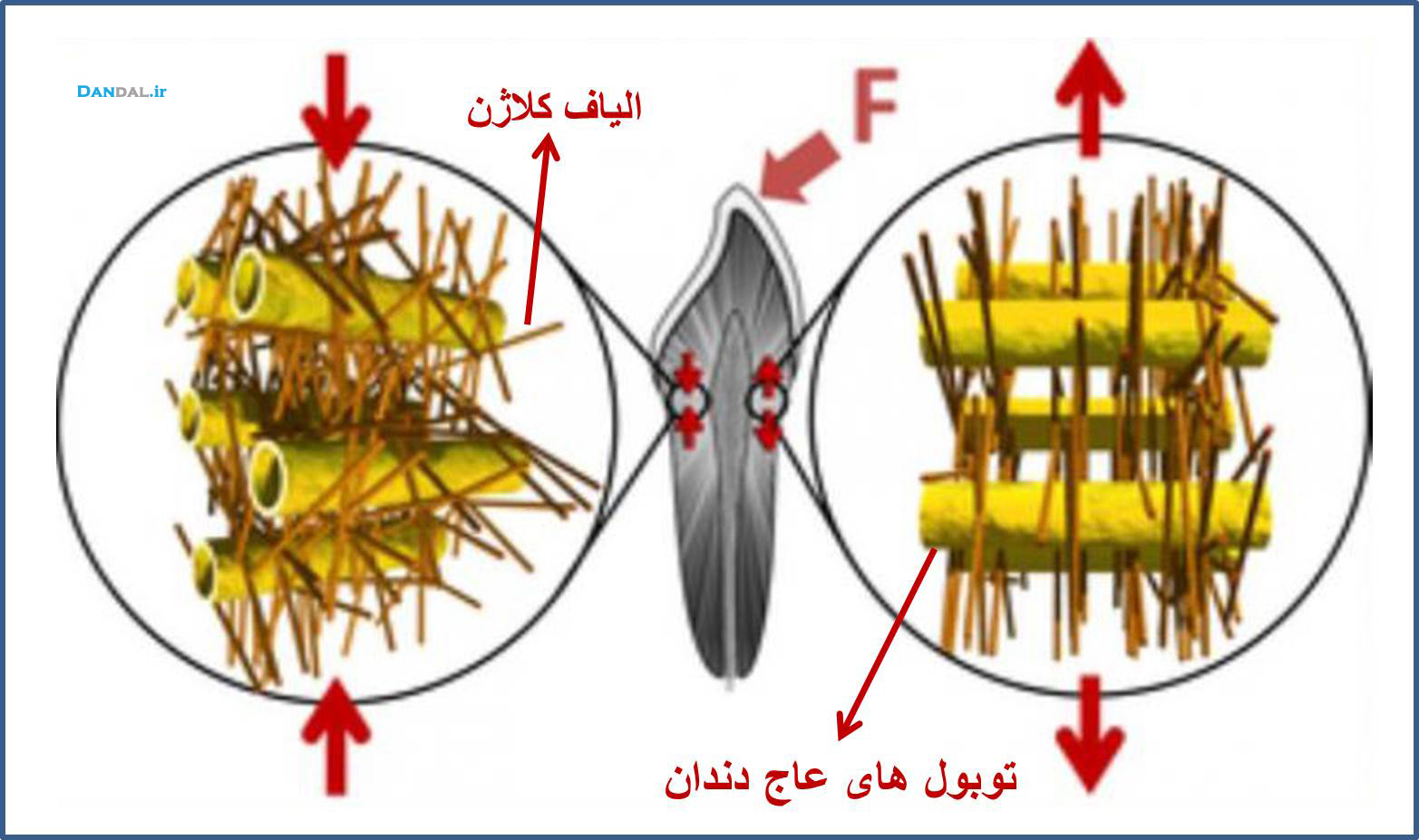 dandal-nanoparticle in teeth