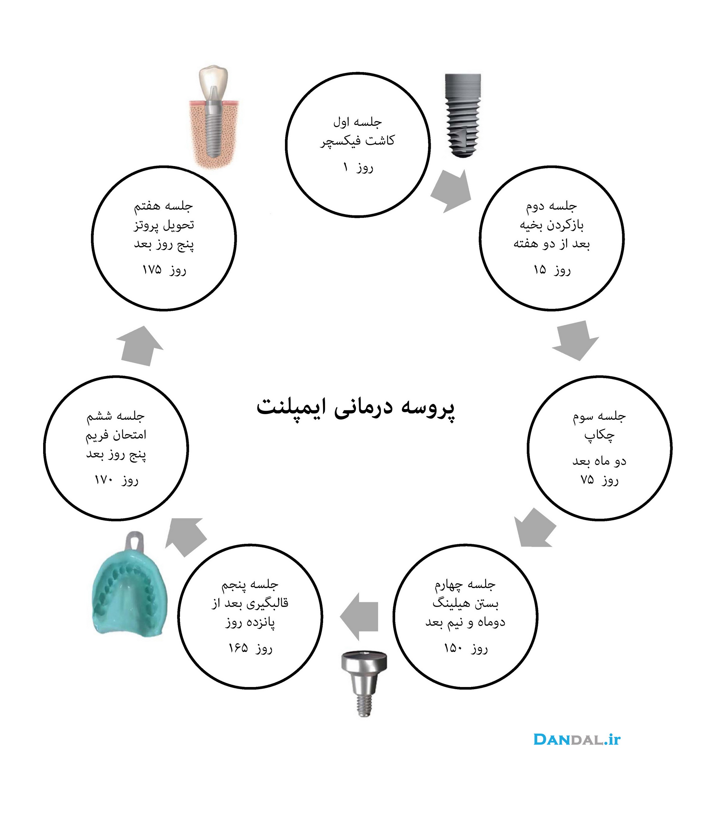 dandal-implant proccess