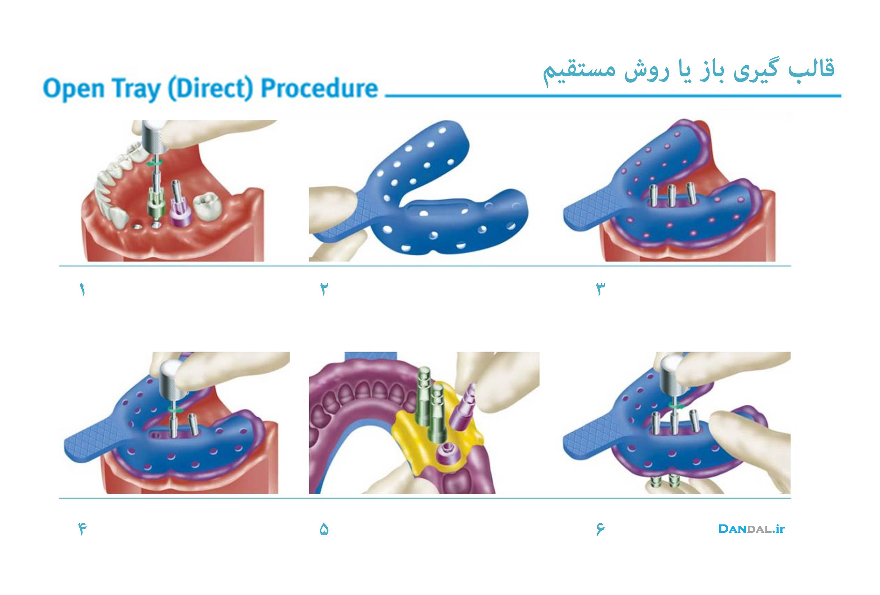 open tray