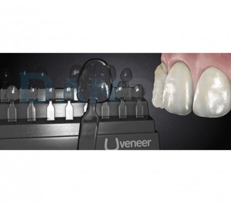 UltraDent - Uveneer Kit