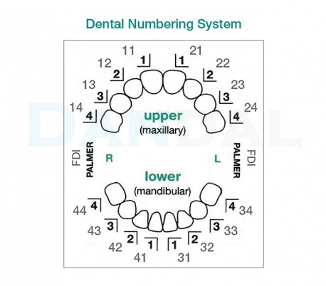 کیت قالب پیش ساخت ونیر (یوونیر) - UltraDent