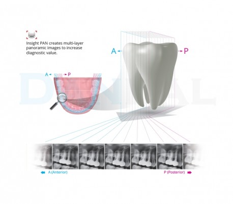 Vatech - PaX-i Insight 2D Imaging