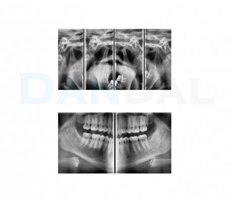 دستگاه رادیوگرافی پانورامیک (OPG) مدل Vatech - PaX-i Insight