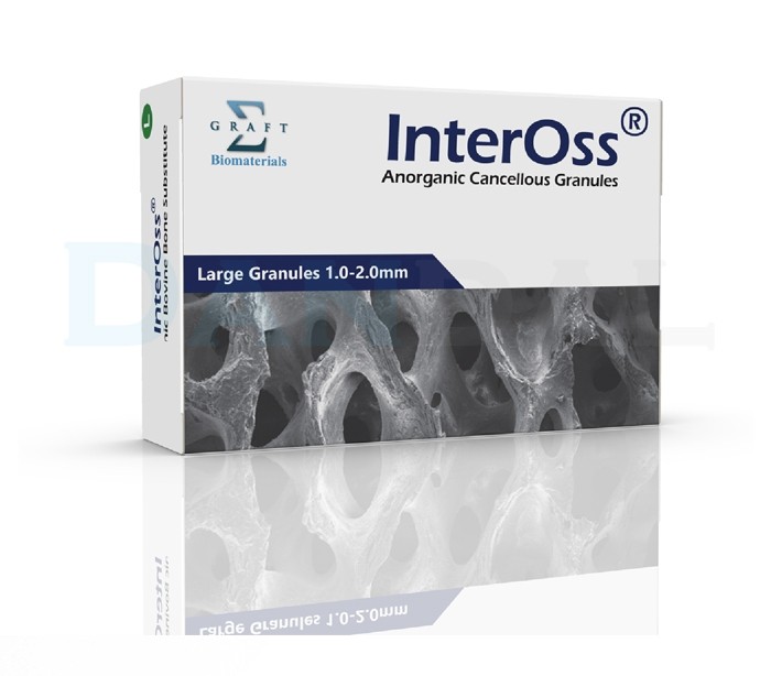 Sigma Graft - InterOss Bone Granules - Dandal Volume V 2cc Particle ...