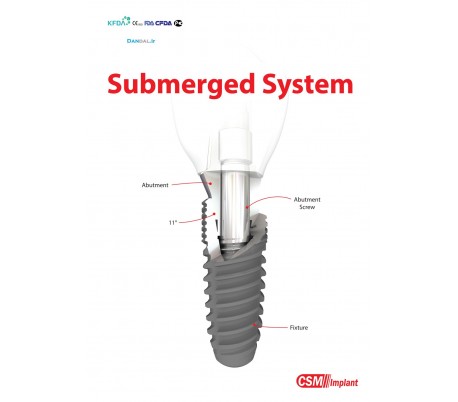 CSM Implant