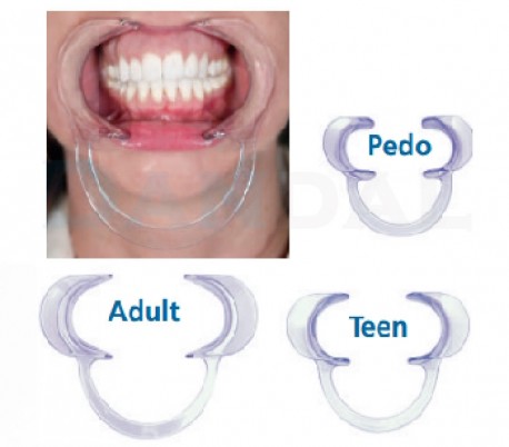 Ortho Technology - Cheek Retractor