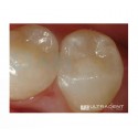 UltraDent - Amelogen Plus Composite