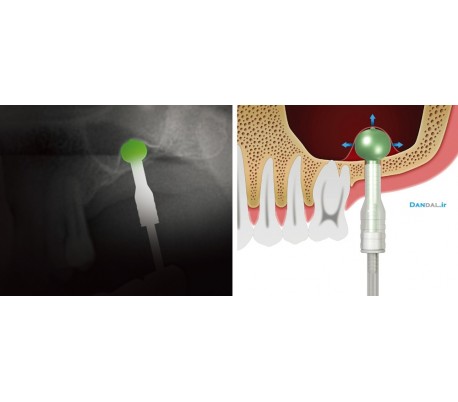 Dentium - Sinus Elevator