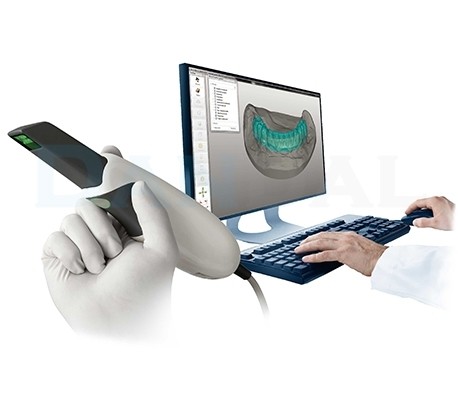 Carestream - CS3500 Intraoral Scanners