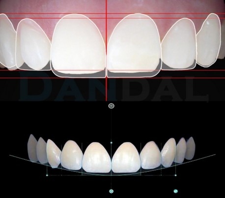 HealTech - Digital Smile Design