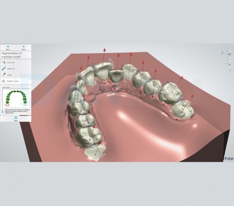 HealTech - Clear Aligners