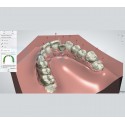 HealTech - Clear Aligners