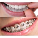 HealTech - Clear Aligners