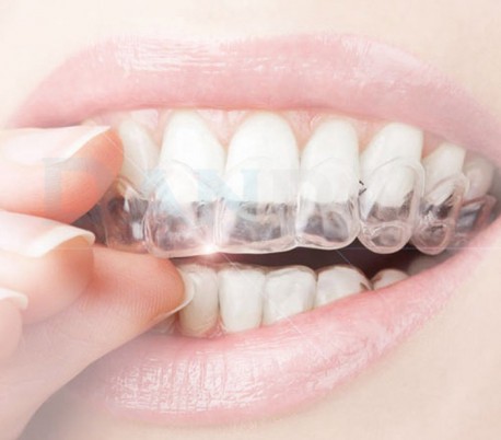 HealTech - Clear Aligners