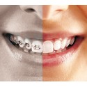 HealTech - Clear Aligners