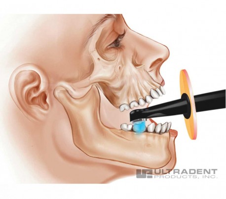 Light Shield لایت کیور UltraDent - VALO