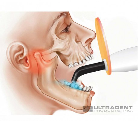 Light Shield لایت کیور UltraDent - VALO