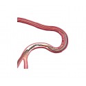 Xience Xpedition Everolimus Eluting Stent - Abbott Vascular