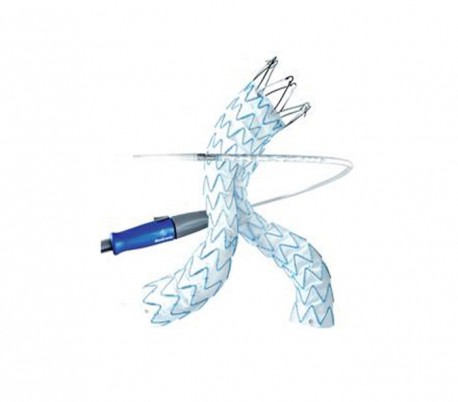 Endurant II Stent Graft - Medtronic