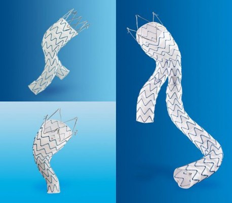 Endurant II Stent Graft - Medtronic