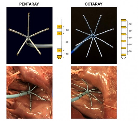 کتتر Biosense Webster - Pentaray