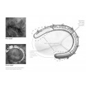 Contour 3D Annuloplasty Ring - Medtronic