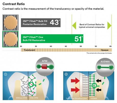 3M - Filtek One Bulk Fill Posterior Restorative Composite