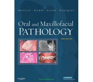 Oral & Maxillofacial Pathology- Neville – 3rd Edition