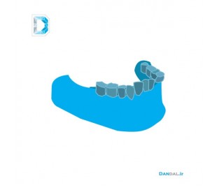 شبیه سازی سه بعدی فک پایین بیمار