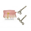 Jeil - Orthodontic Anchor Plate