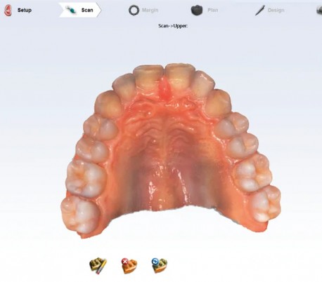 Planmeca - Emerald S Colored Intraoral Scanner