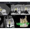 اسکنر داخل دهانی رنگی Planmeca - Emerald S