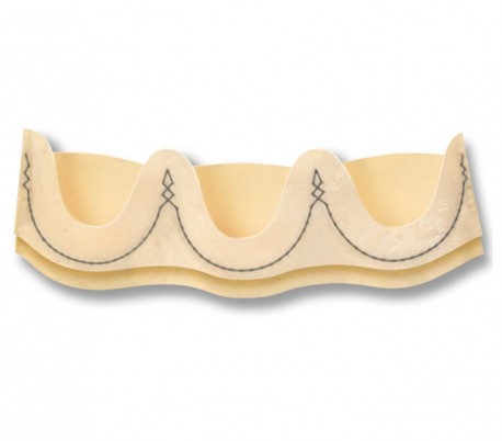 Sorin - Pericarbon More Mitral Stented Pericardial Valve