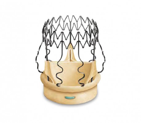 Sorin - Perceval Aortic Heart Valve