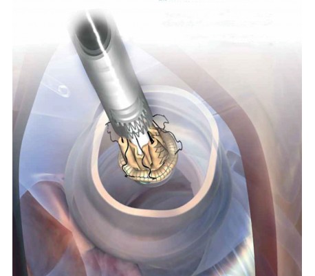 Sorin - Perceval Aortic Heart Valve