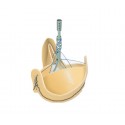 Sorin - Solo Smart Aortic Heart Valve