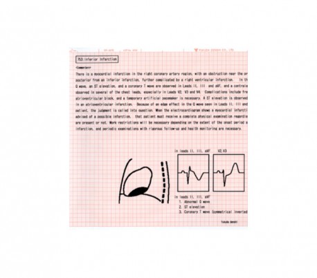 Fukuda Denshi - Electrocardiograph Cardimax FX-8322