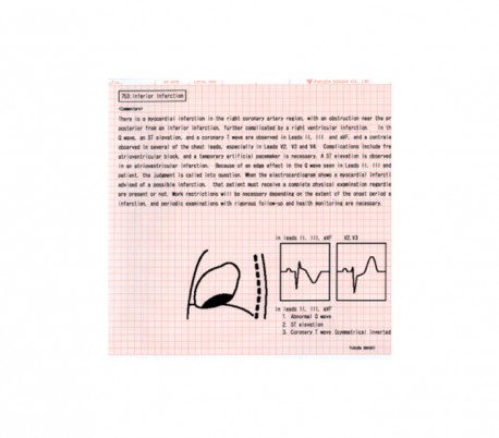 Fukuda Denshi - Electrocardiograph Cardimax FX-8322R