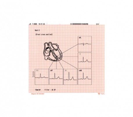 دستگاه الکتروکاردیوگرافی  Fukuda Denshi - Cardimax FX-8222