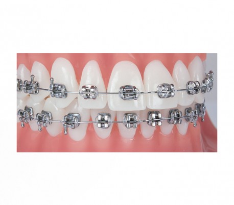 Ortho Technology - Roth Pinnacle Bracket with Hook