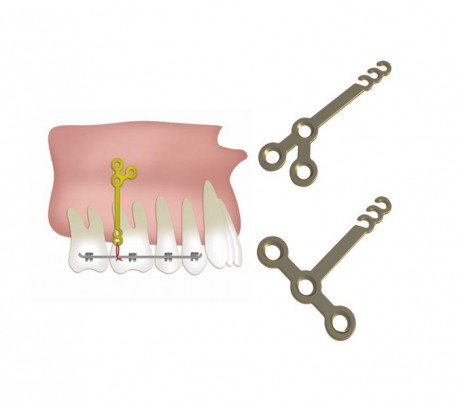 Jeil - Orthodontic Anchor Plate