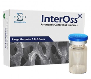 گرانول Sigma Graft - InterOss