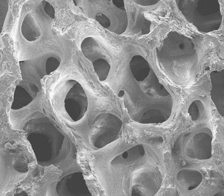 پودر استخوان سرنگی Sigma Graft - InterOss