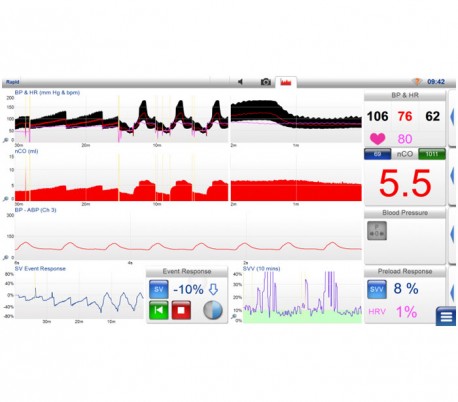 Lidco - LiDCOunity Monitor