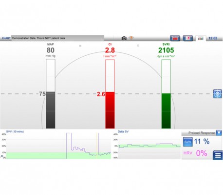 Lidco - LiDCOunity Monitor