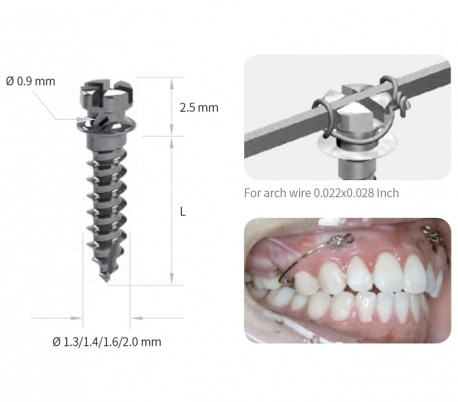 Jeil - Dual-Top G2 Mini Screw