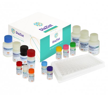 DiaZist - Anti-SARS-CoV-2 S1-RBD (IgG) ELISA Kit