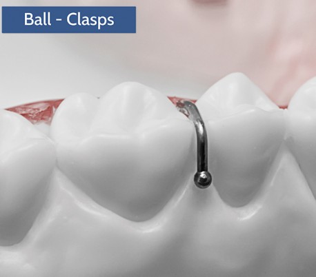 Dentaurum - SUS2 Ball Retainer Clasp